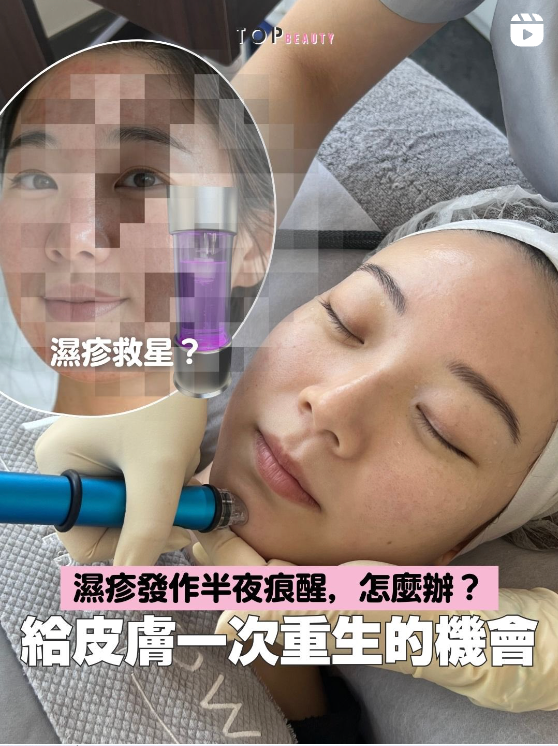 topglow topbeauty